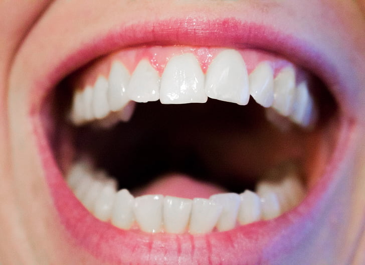 human's teeth